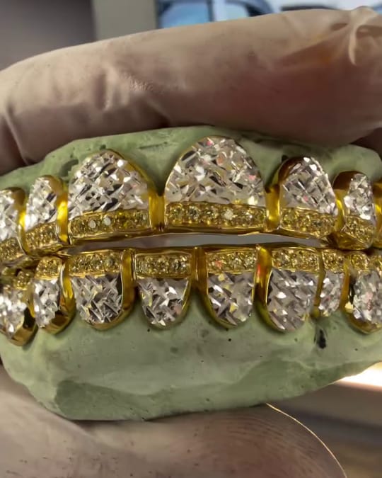 Ten on ten yellow gold grillz with diamond cut faces and a row of yellow stones