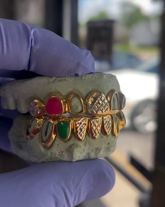 Yellow gold open face grillz with red and green stones, held on a mold