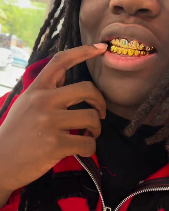 A customer pulls back his lip to show his new gold grill in the shop