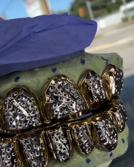 Fully iced diamond grillz on a dental mold