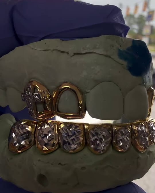 Open face top and diamond cut bottom grillz with a small diamond faith symbol on one tooth