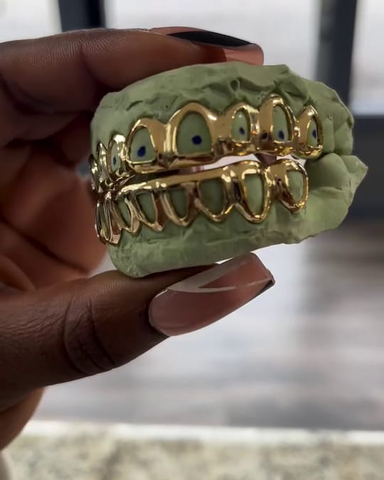 Gold open face top and bottom set on a mold, held up to the shop window