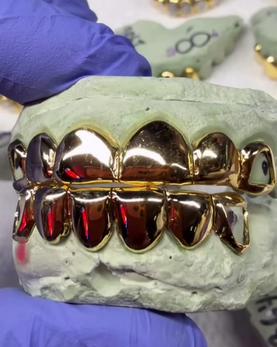 Solid gold top and bottom grillz on a mold