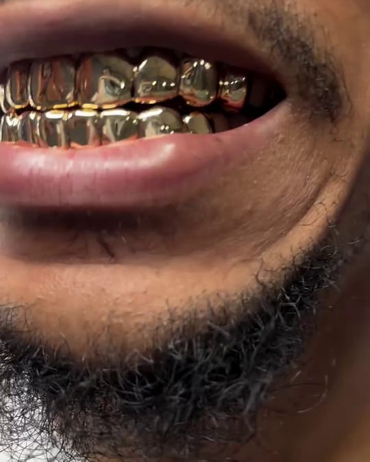 Close up of a customer wearing a full set of polished gold grillz
