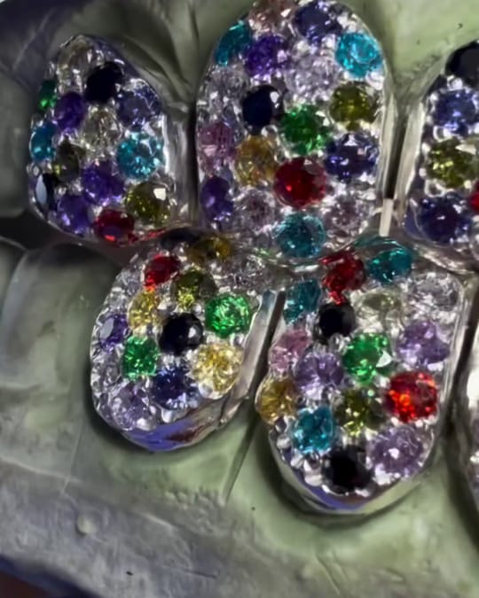 Grillz set with mixed colored stones in red, green, blue and purple