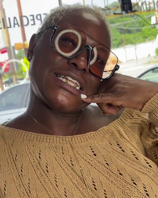 A customer smiling to show her new permanent gold caps