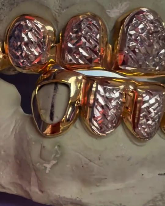 Gold grillz with pink and white diamond cut faces and one open face tooth