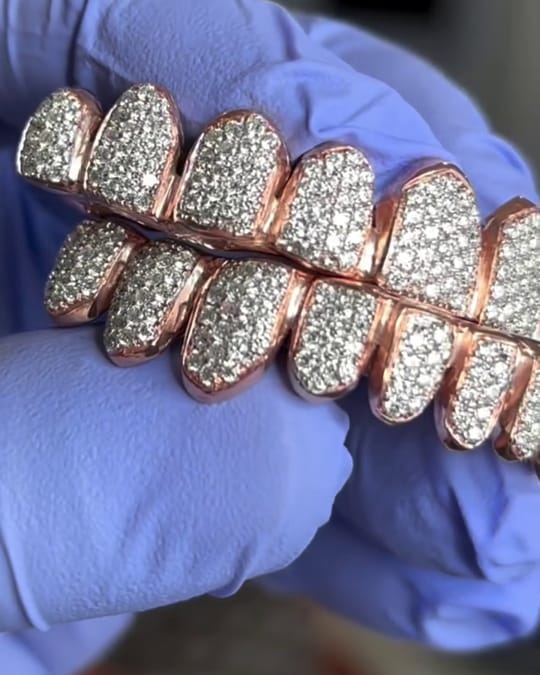 Rose gold bottom grill fully set with diamonds, held between gloved fingers