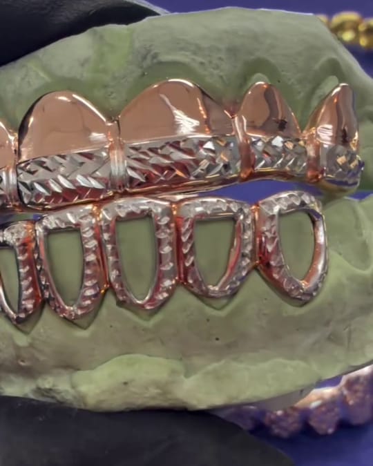 Rose gold grillz: diamond cut top row and open face bottom row on a mold
